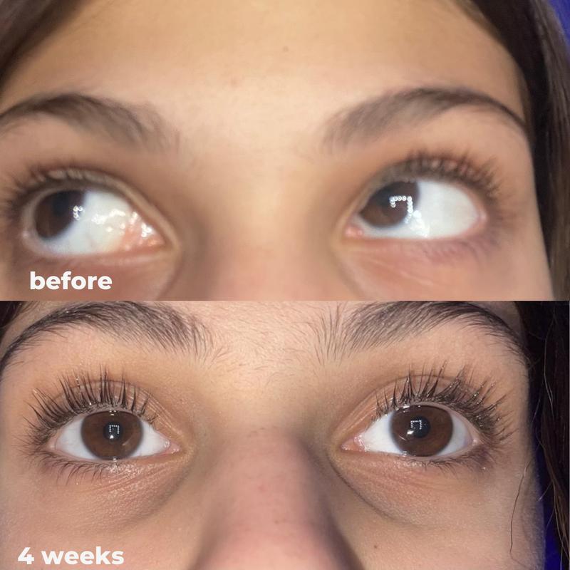LashRX Eyelash Serum