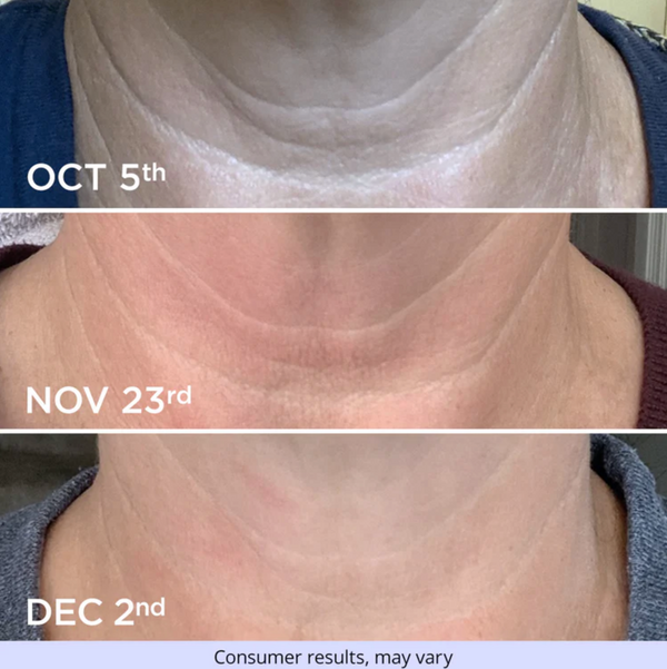 Tightening & Lift Neck Cream