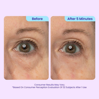 Instant Eyelift Gel - For Puffiness & Bags, Wrinkles, Fine Lines and Dark Circles