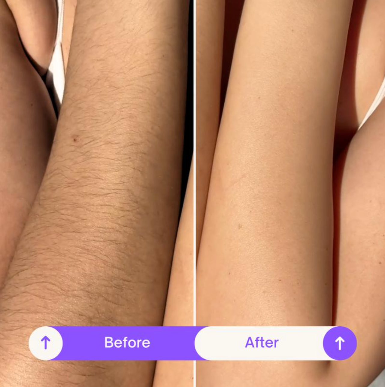 Body Hair Removal Cream
