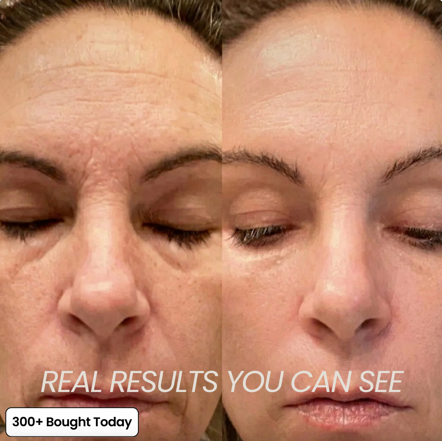 Transform Wrinkles, Fine Lines, And Tired Creases Naturally
